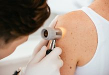 Un ghid pas cu pas pentru autoexaminarea cancerului de piele
