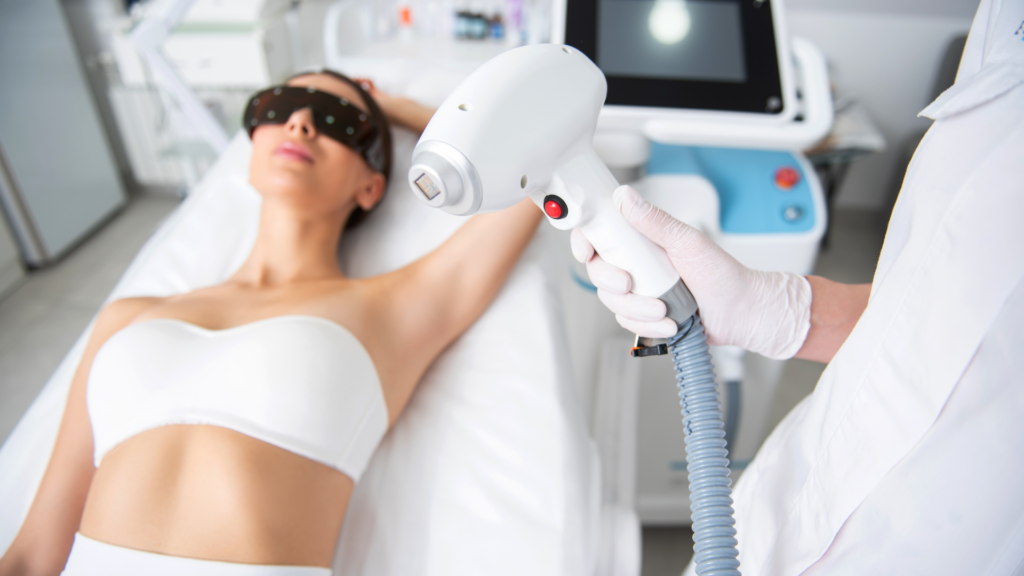 epilarea cu laser iarna